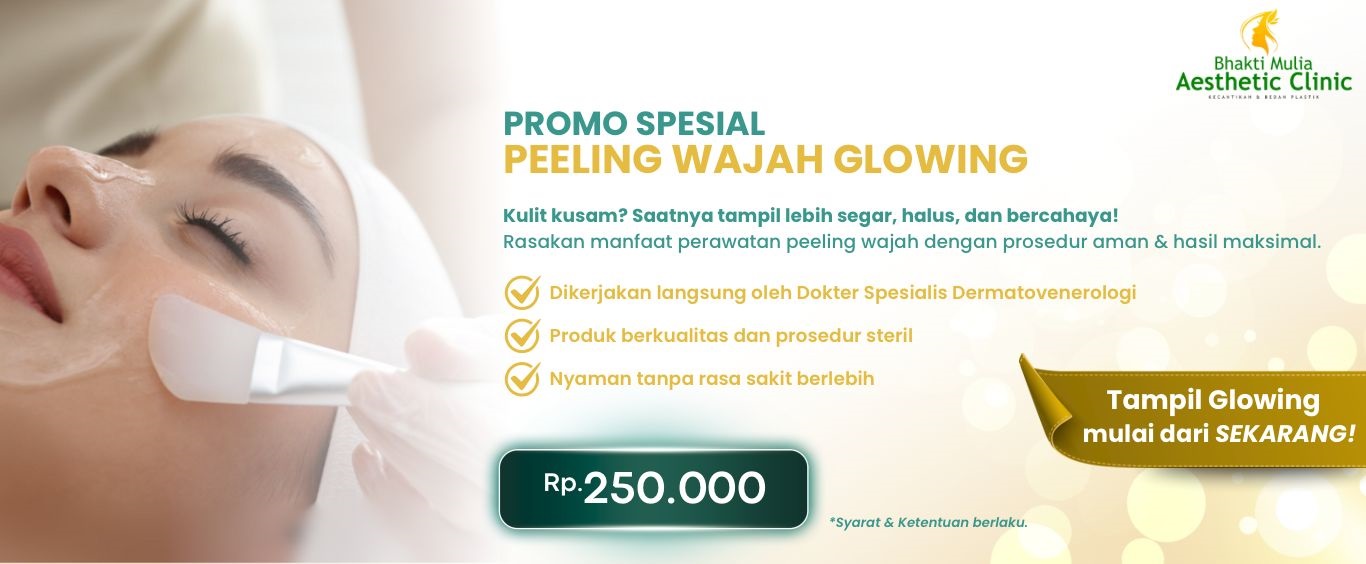 promofilling
